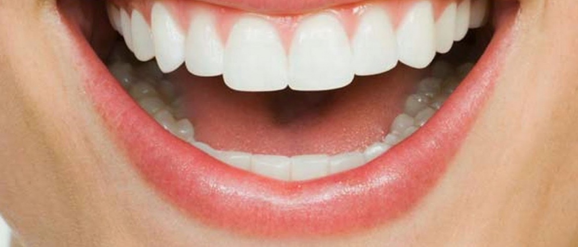 Tips To Keep Your Teeth White And Healthy