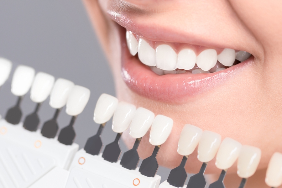 Things You Need To Know Before You Start The Teeth Whitening Process